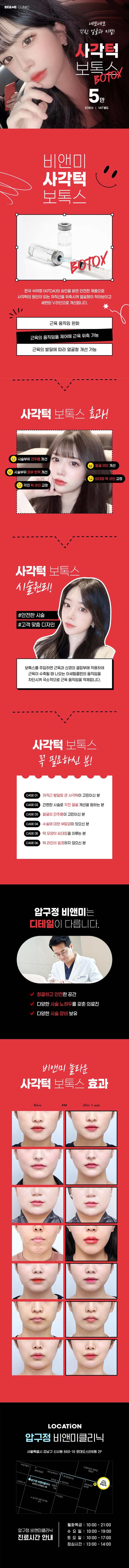 압구정비앤미의원 압구정비앤미 사각턱보톡스 이벤트, 시술 상세 이미지
