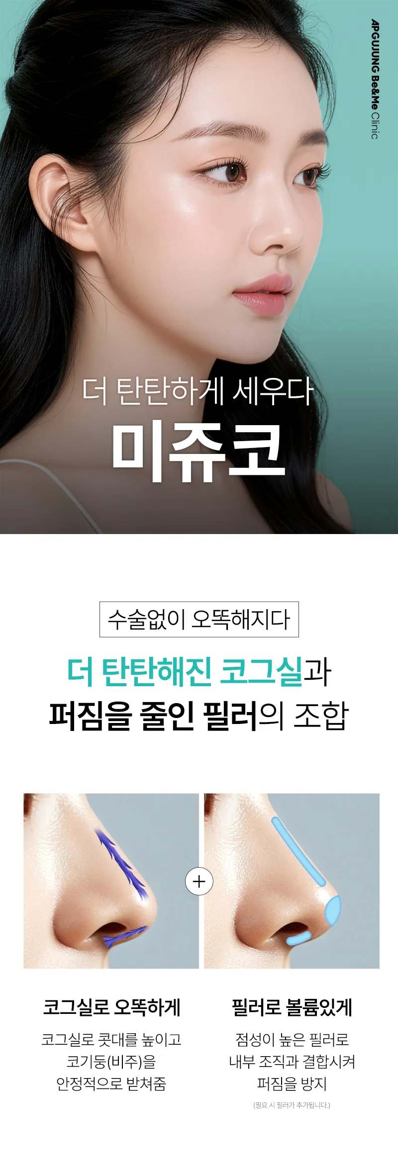 압구정비앤미의원 비앤미 오래오래 오똑하게, 미쥬코 이벤트, 시술 상세 이미지