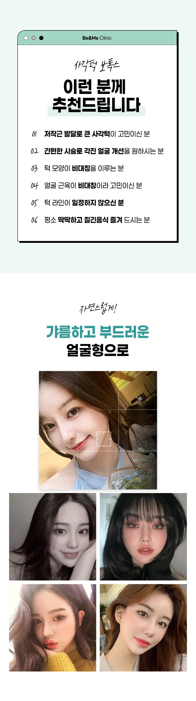 압구정비앤미의원 압구정비앤미 사각턱보톡스 V라인 이벤트, 시술 상세 이미지