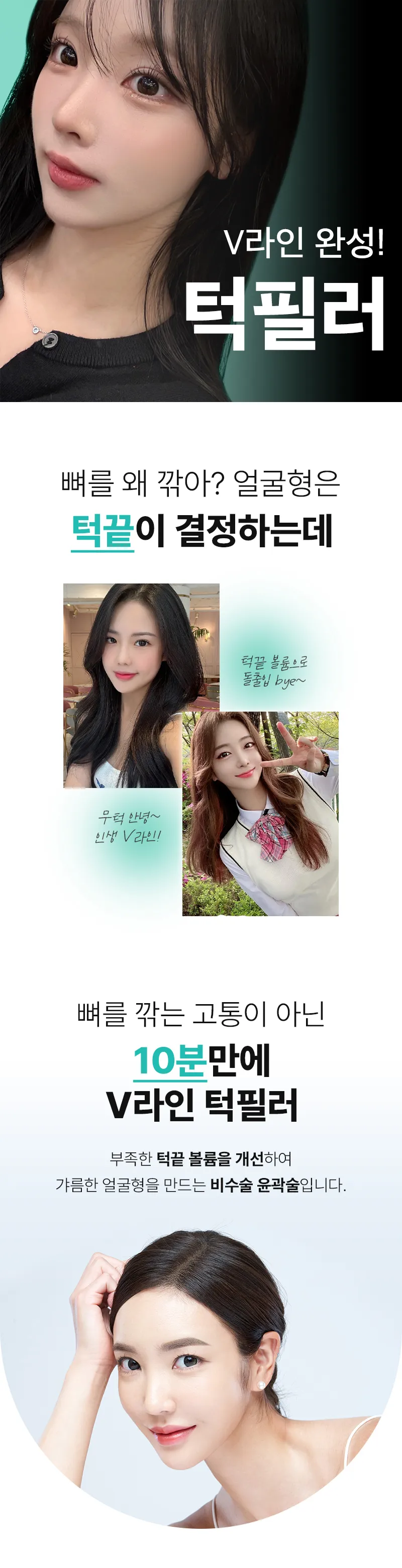 압구정비앤미의원 비앤미 앞턱 V필러 이벤트, 시술 상세 이미지