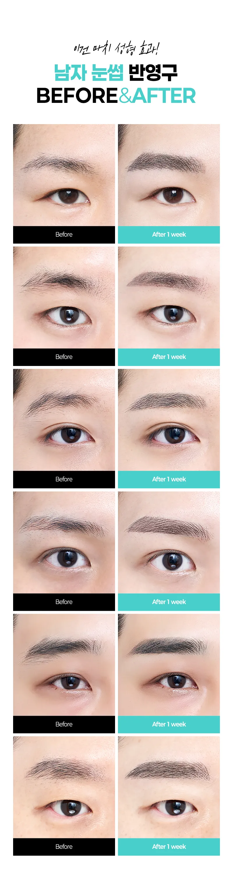 압구정비앤미의원 비앤미  남자 반영구눈썹   이벤트, 시술 상세 이미지