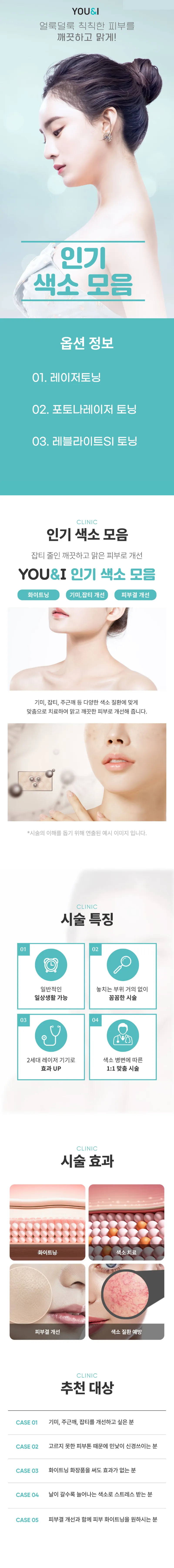 유앤아이의원 목포점 색소 잡는 토닝 모음 이벤트, 시술 상세 이미지