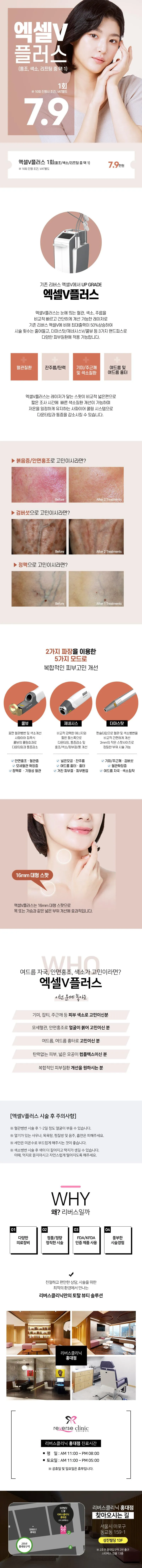 리버스클리닉 홍대점 홍조 색소 리프팅 고민엔 엑셀V플러스 이벤트, 시술 상세 이미지