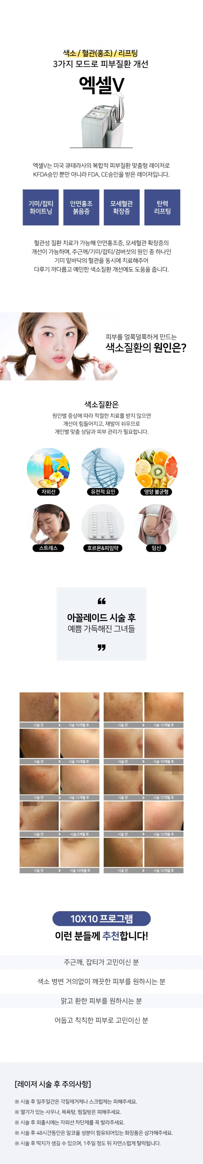 리버스클리닉 수원점 리버스 10X10 색소개선 패키지 이벤트, 시술 상세 이미지