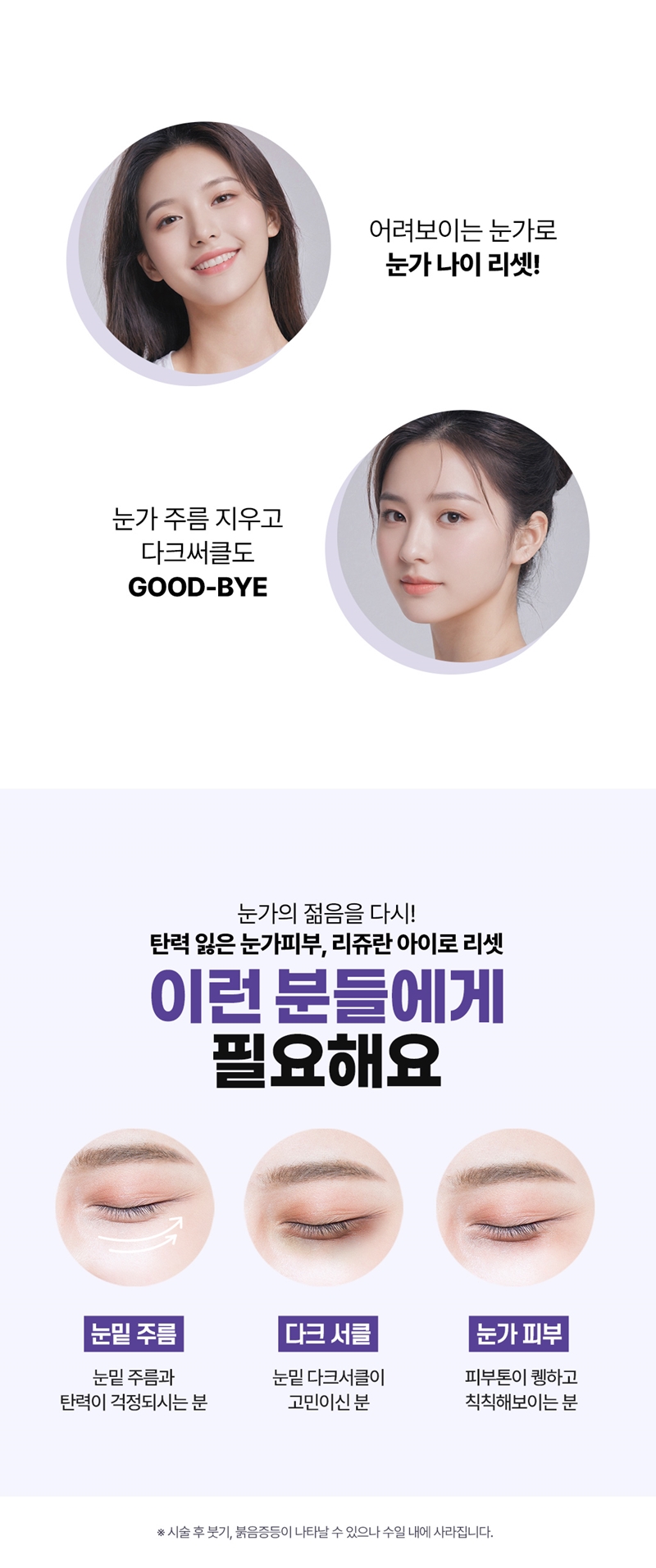 리버스클리닉 수원점 리쥬란아이 2cc 진정관리 팩 관리 이벤트, 시술 상세 이미지