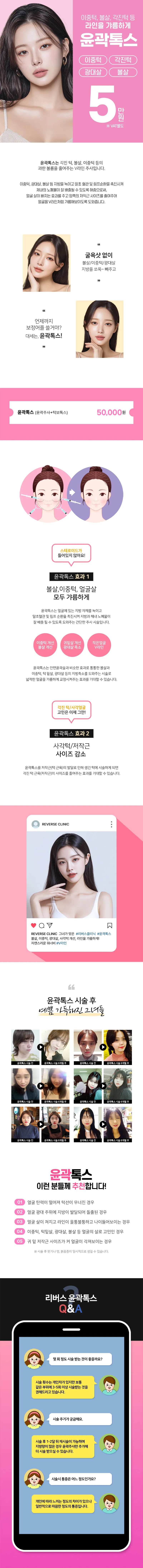 리버스클리닉 수원점 갸름한 V라인 윤곽톡스 이벤트, 시술 상세 이미지