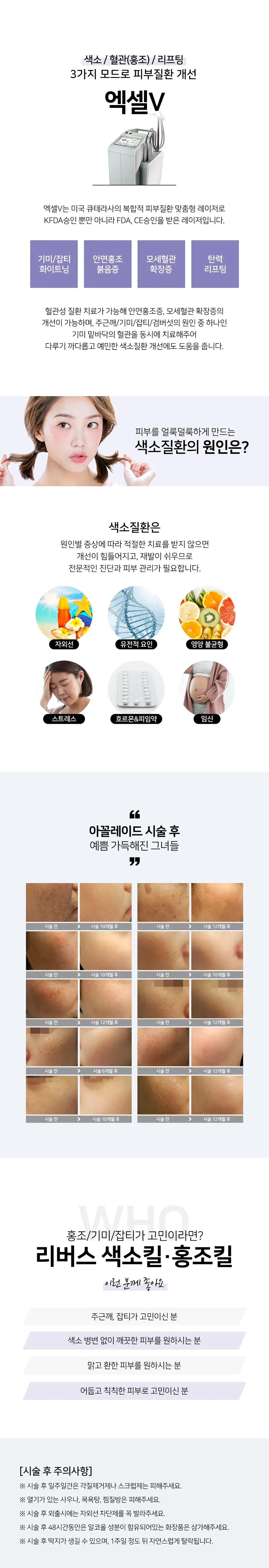 리버스클리닉 수원점 체험 아꼴레이드색소킬or엑셀V홍조킬 이벤트, 시술 상세 이미지