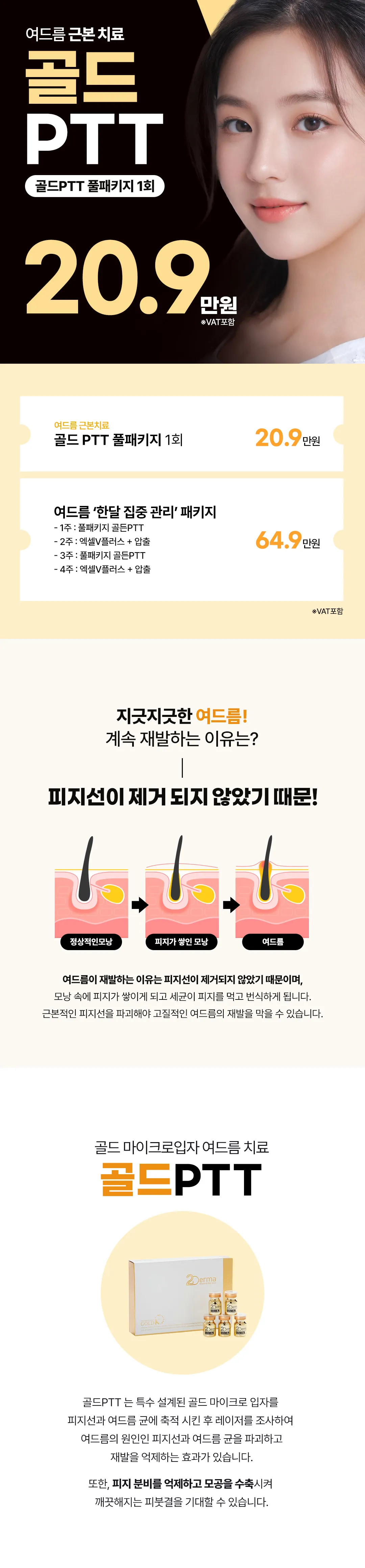 여드름 근본치료 골드PTT 풀패키지