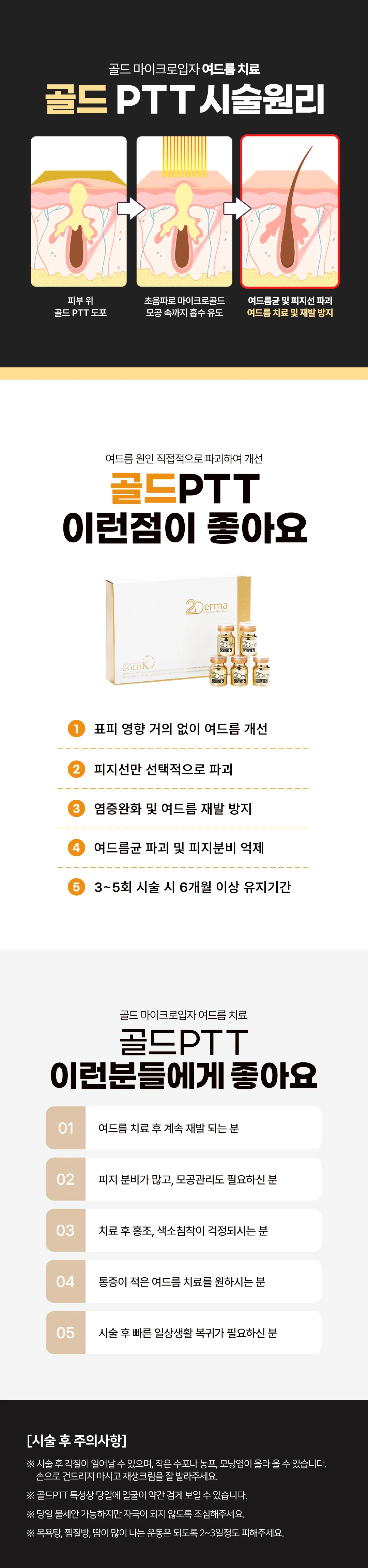 여드름 근본치료 골드PTT 풀패키지
