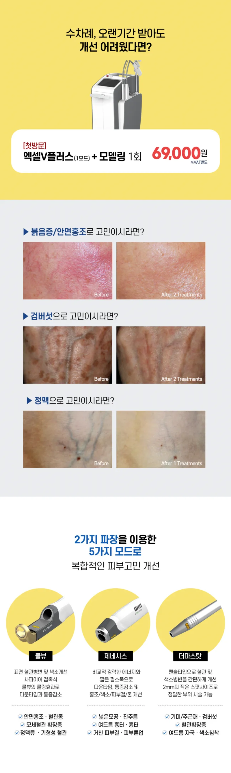 리버스클리닉 인천구월점 인천구월점 첫방문이벤트) 엑셀V플러스 이벤트, 시술 상세 이미지