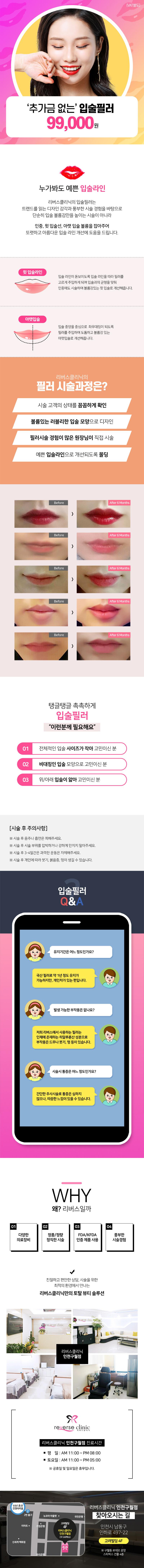리버스클리닉 인천구월점 추가금 없는 입술필러 이벤트, 시술 상세 이미지