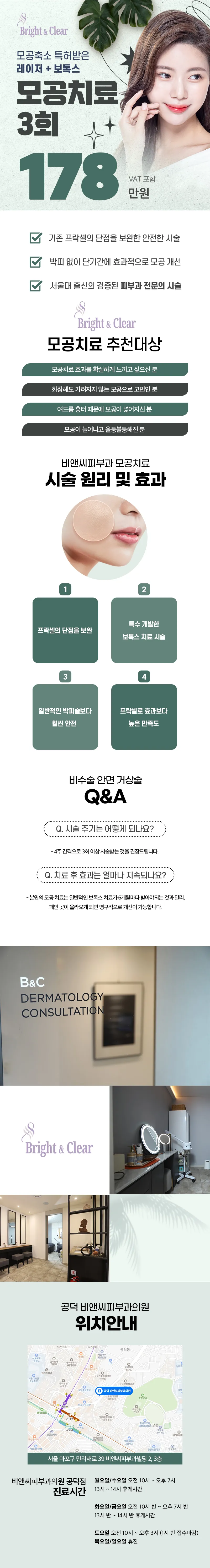 비앤씨피부과의원 공덕점 [공덕 비앤씨피부과] 모공치료 3회 이벤트, 시술 상세 이미지