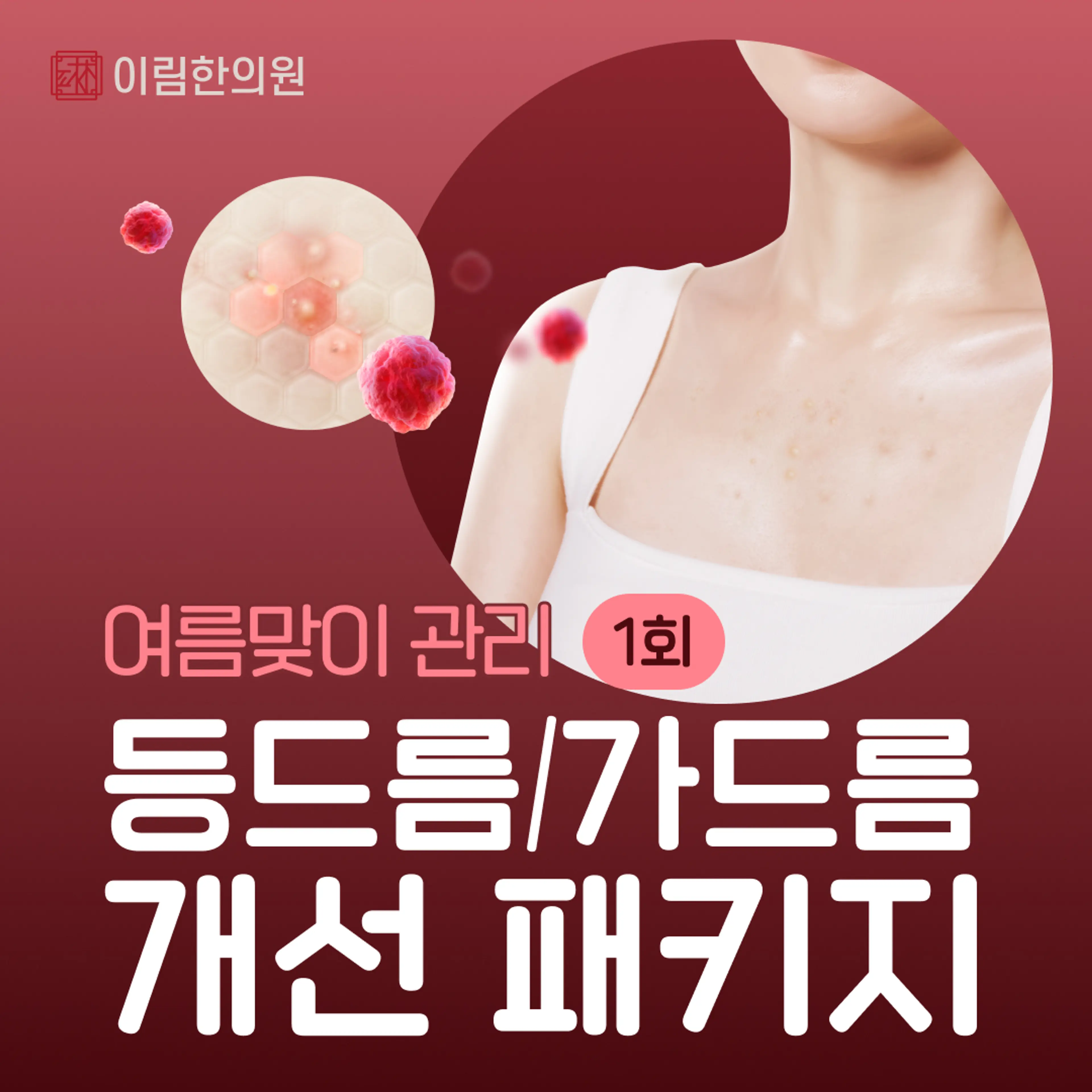 등드름, 가드름 개선 패키지