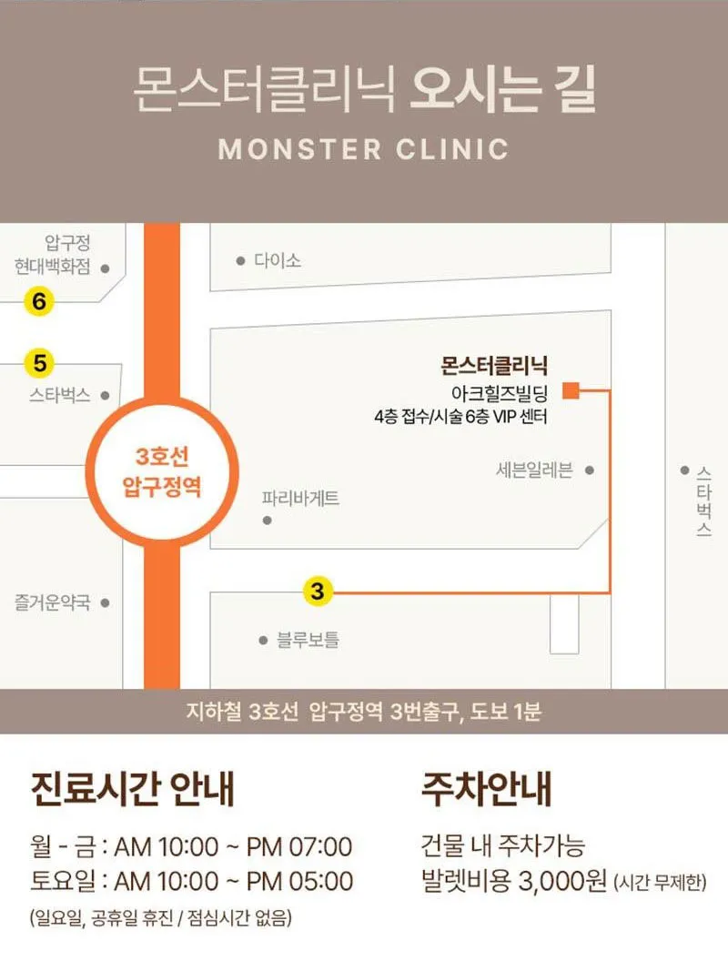 몬스터의원 쥬베룩 5CC 쥬베룩볼륨 이벤트, 시술 상세 이미지