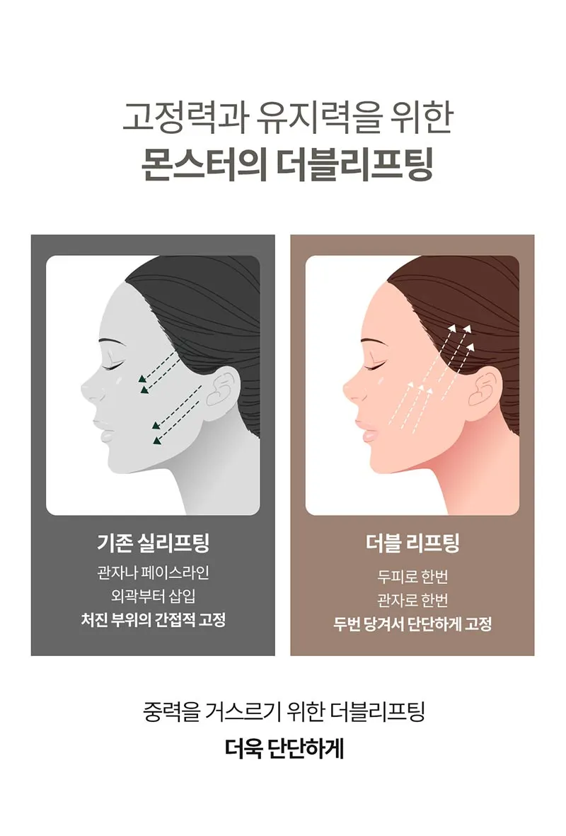 몬스터의원 단독특가★ 실리프팅 짱짱하게 리프팅 이벤트, 시술 상세 이미지