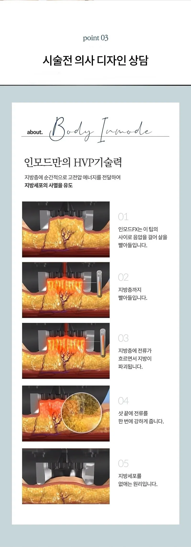 몬스터의원 양측포함 바디 인모드 FX  이벤트, 시술 상세 이미지