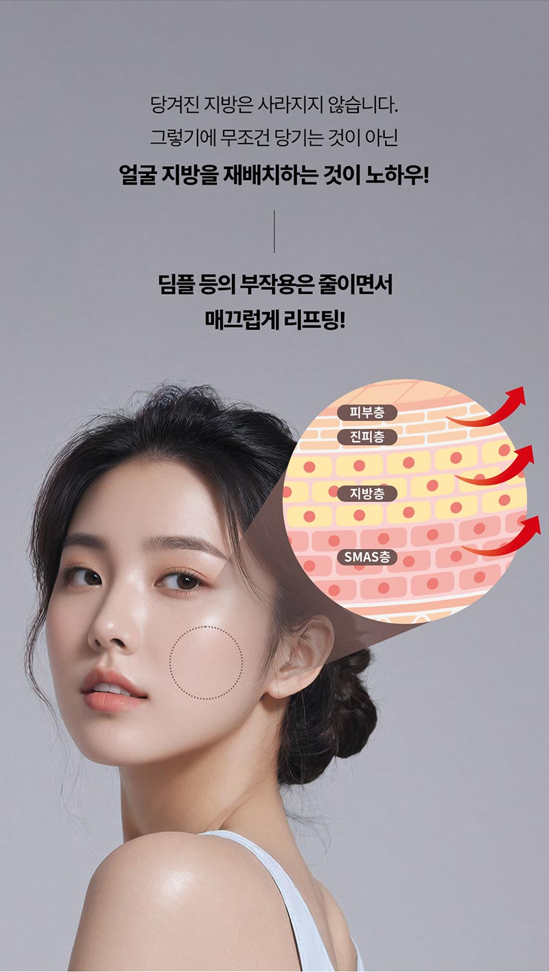 몬스터의원 단독특가★ 실리프팅 짱짱하게 리프팅 이벤트, 시술 상세 이미지