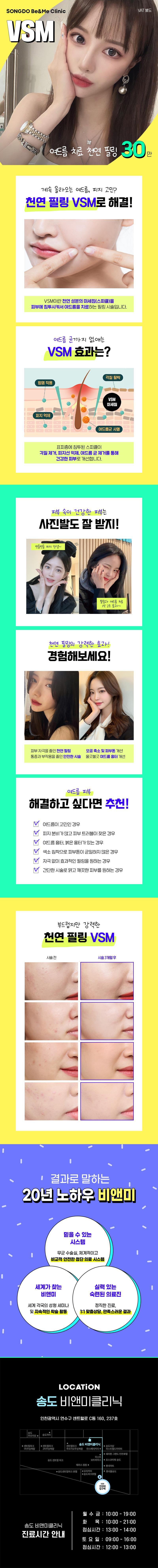송도비앤미의원 여드름 지우개 VSM 이벤트, 시술 상세 이미지