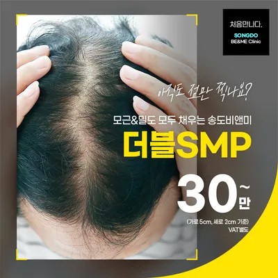 송도비앤미 두피반영구 더블SMP 이벤트 썸네일 이미지