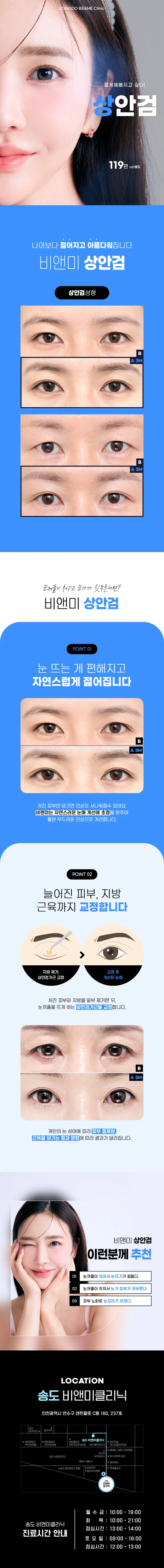 송도리앤스타의원 송도비앤미 중년눈성형 상안검  이벤트, 시술 상세 이미지