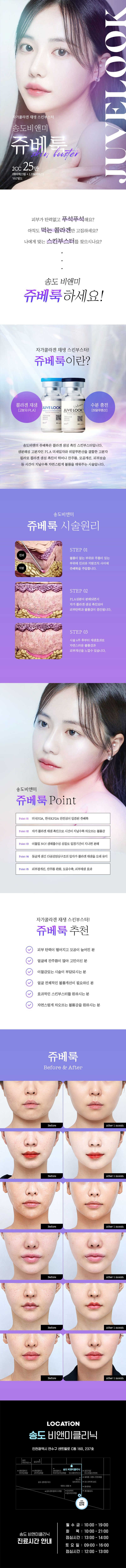 송도비앤미의원 송도비앤미 자가콜라겐재생 쥬베룩 이벤트, 시술 상세 이미지