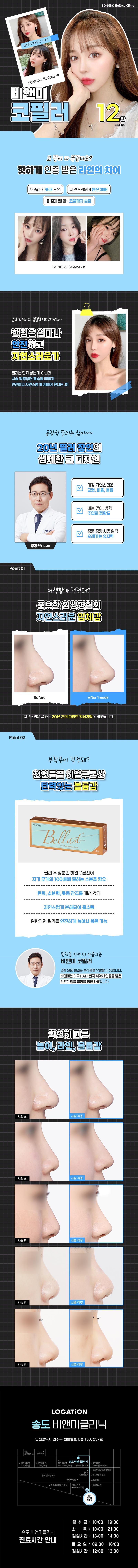 송도비앤미의원 송도비앤미 맞춤 코필러 이벤트, 시술 상세 이미지