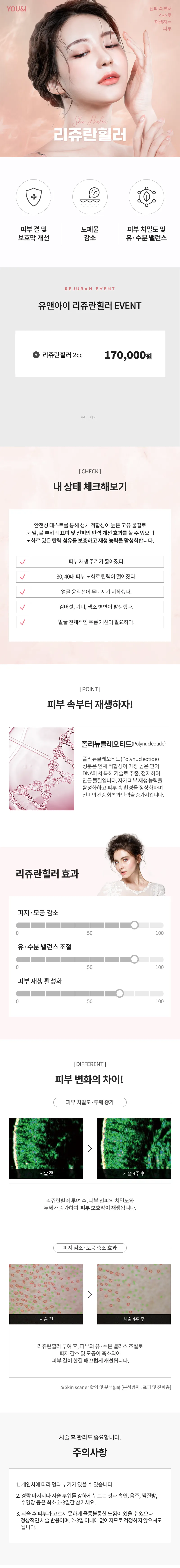 유앤아이의원 부산점 부산) 피부재생 리쥬란힐러 이벤트, 시술 상세 이미지