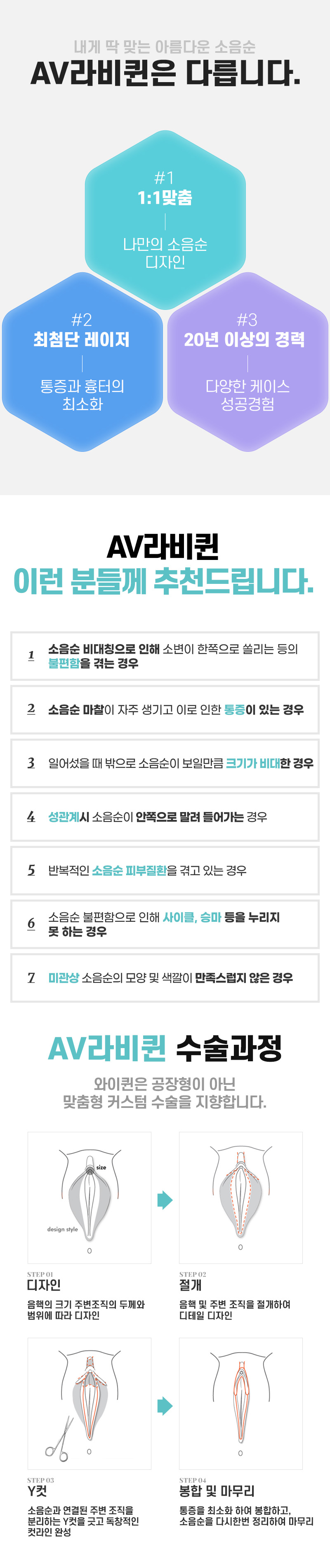 와이퀸산부인과의원 소음순수술 내게 '딱'맞는 디자인으로 이벤트, 시술 상세 이미지