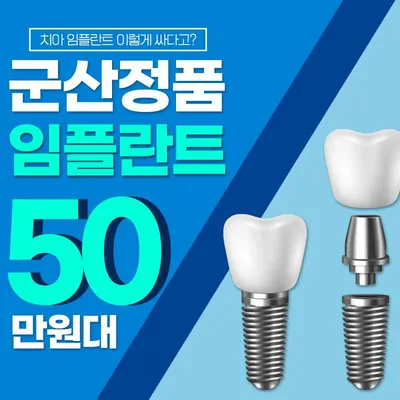 군산시민 한정 59만원 임플란트 특가 이벤트 썸네일 이미지