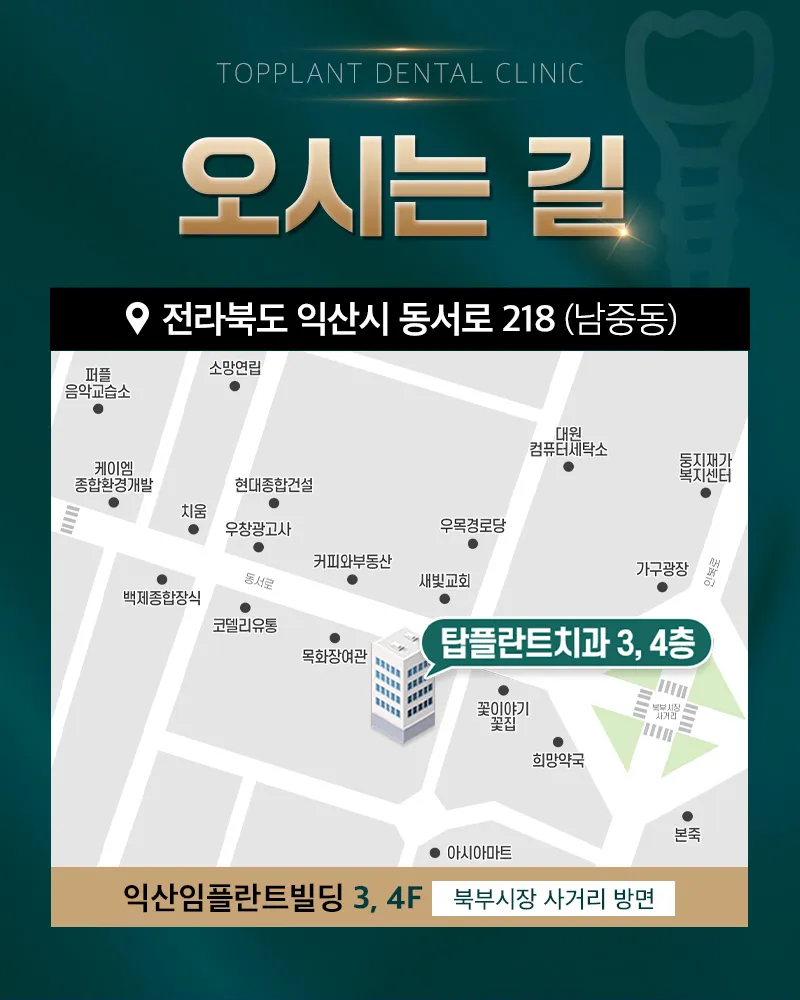 탑플란트치과의원 익산 국산 원데이 임플란트 69만원 -> 49만원 이벤트, 시술 상세 이미지