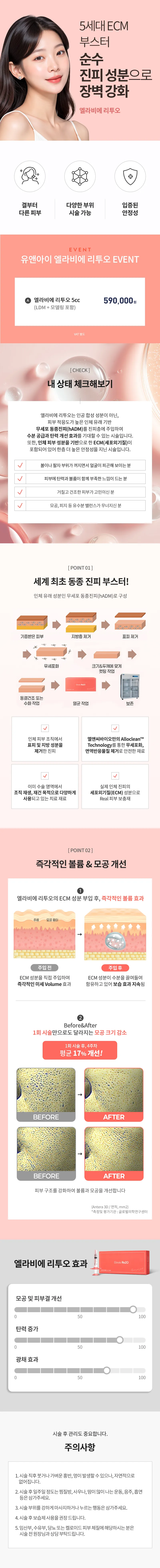 유앤아이의원 대전점 대전) 엘라비에 리투오 특가 이벤트, 시술 상세 이미지