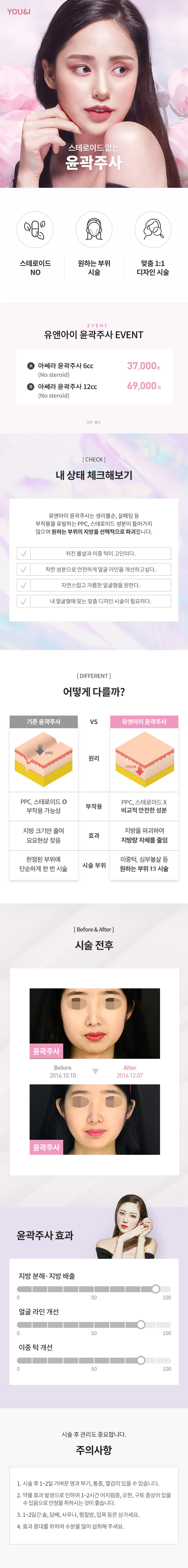 유앤아이의원 대전점 대전) 스테로이드 없는 윤곽주사 이벤트, 시술 상세 이미지