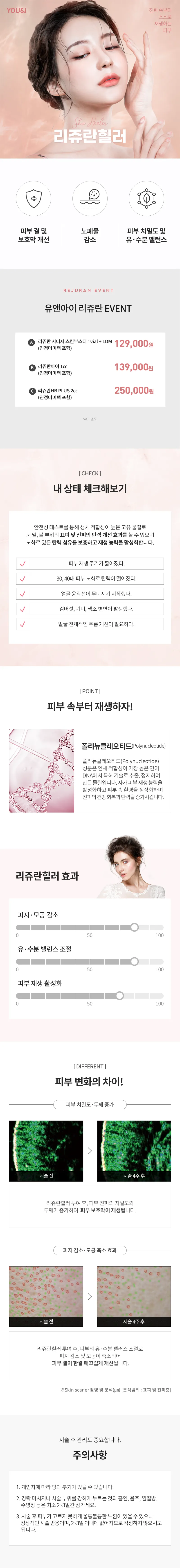 유앤아이의원 대전점 대전) 피부재생 리쥬란힐러 이벤트, 시술 상세 이미지