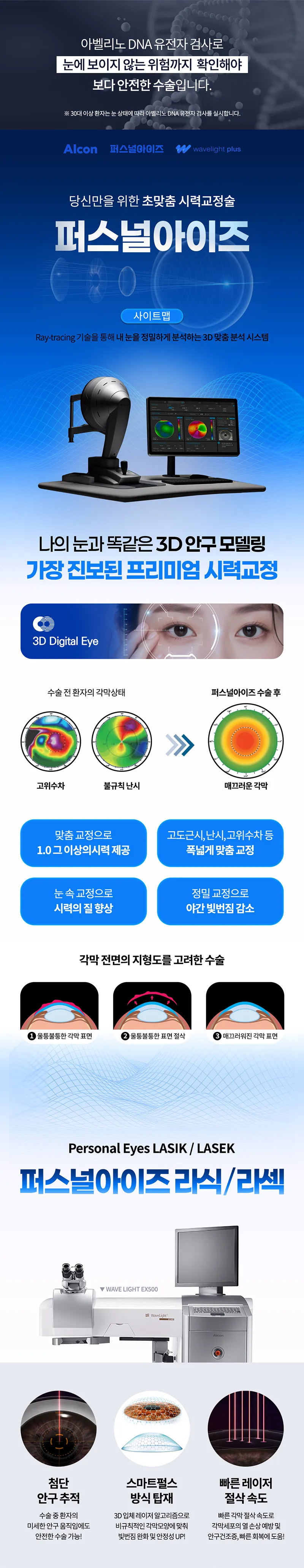 밝음나눔안과 강남점 퍼스널아이즈 라섹 이벤트, 시술 상세 이미지