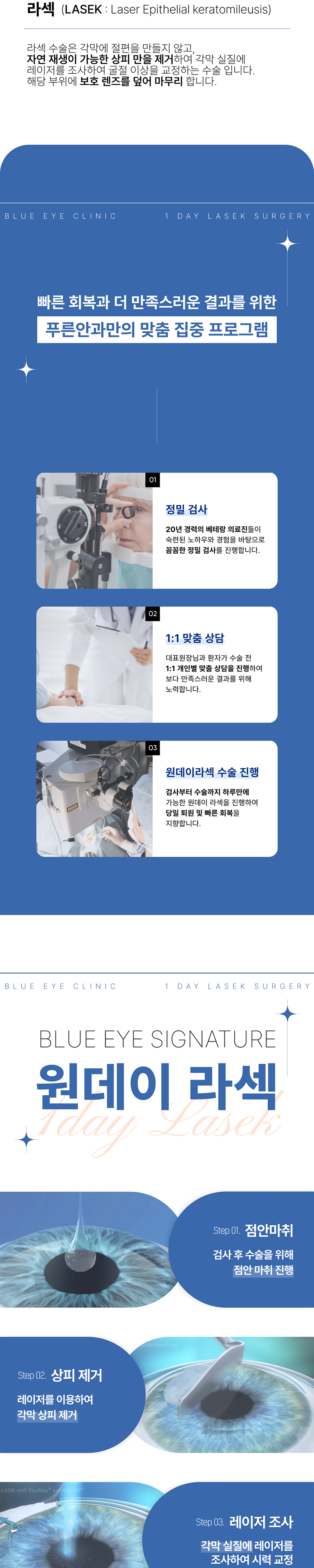 강남푸른안과 추가금없이 99만원, 원데이 라섹 이벤트, 시술 상세 이미지