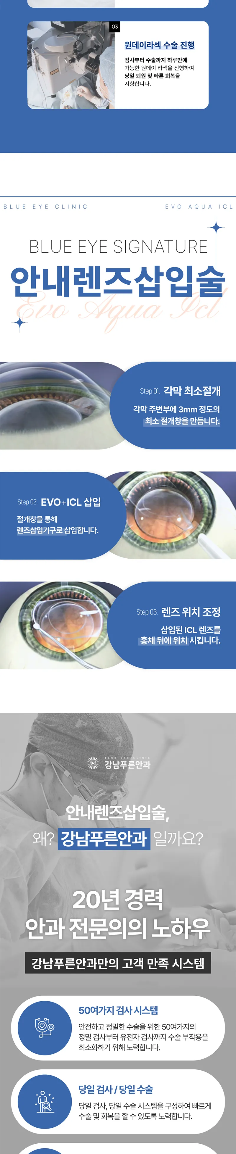 강남푸른안과 원데이 안내렌즈삽입술 450만원 이벤트, 시술 상세 이미지