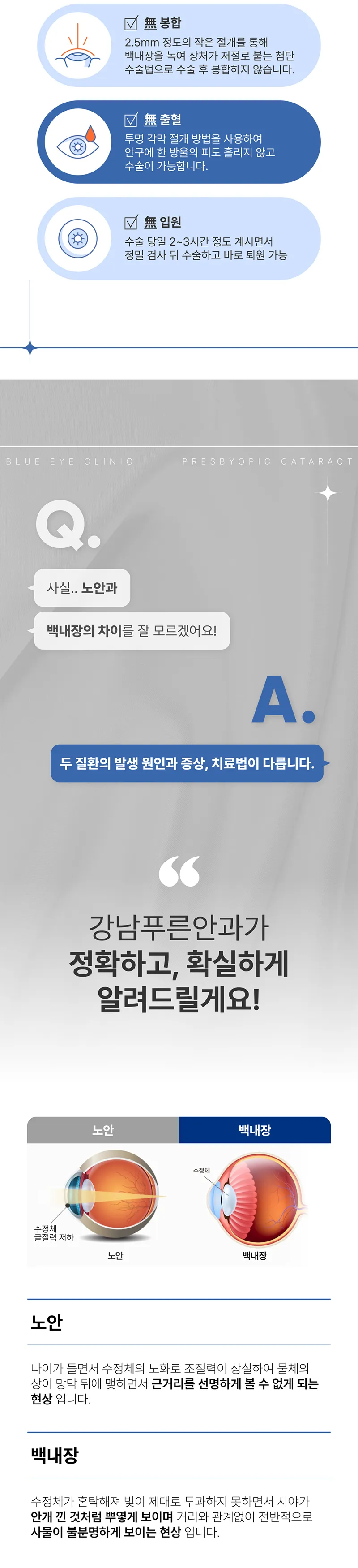 강남푸른안과 노안 백내장 390만원 이벤트, 시술 상세 이미지