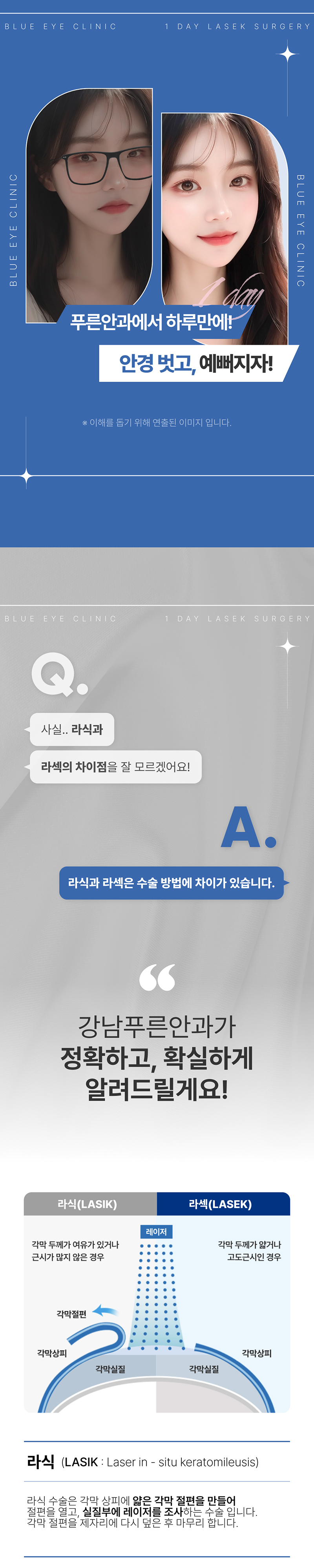 강남푸른안과 추가금없이 99만원, 원데이 라섹 이벤트, 시술 상세 이미지
