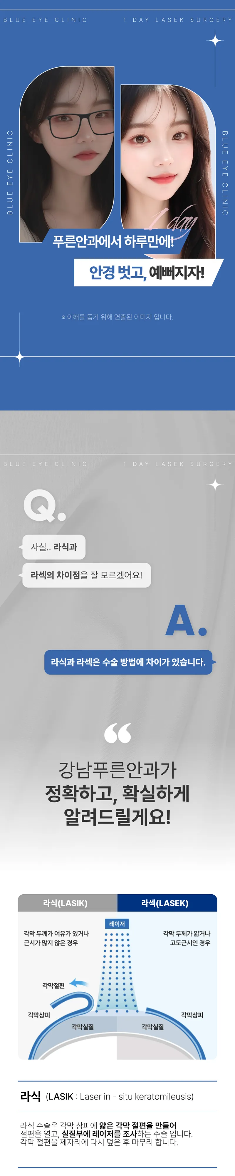 강남푸른안과 추가금없이 99만원, 원데이 라섹 이벤트, 시술 상세 이미지