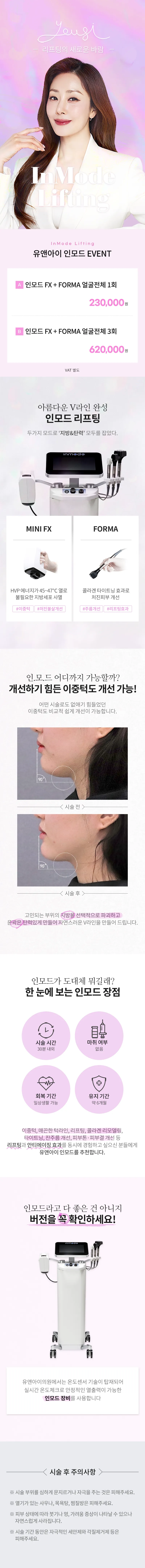 유앤아이의원 평택점 평택) V라인 만드는 인모드 리프팅 이벤트, 시술 상세 이미지