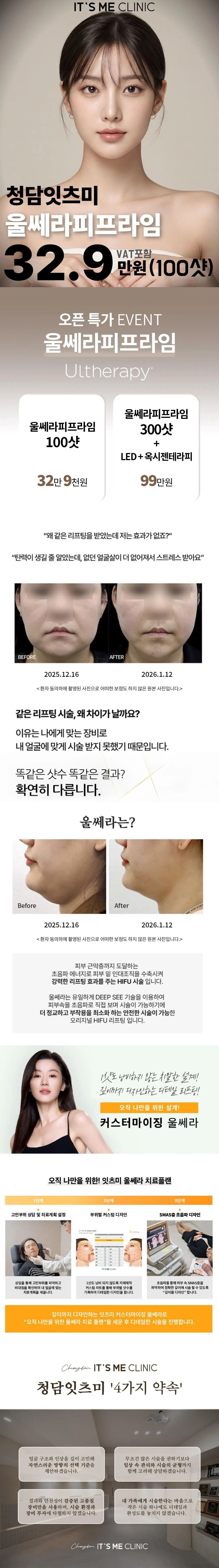 청담잇츠미 의원 울쎄라피프라임 오픈특가 이벤트, 시술 상세 이미지