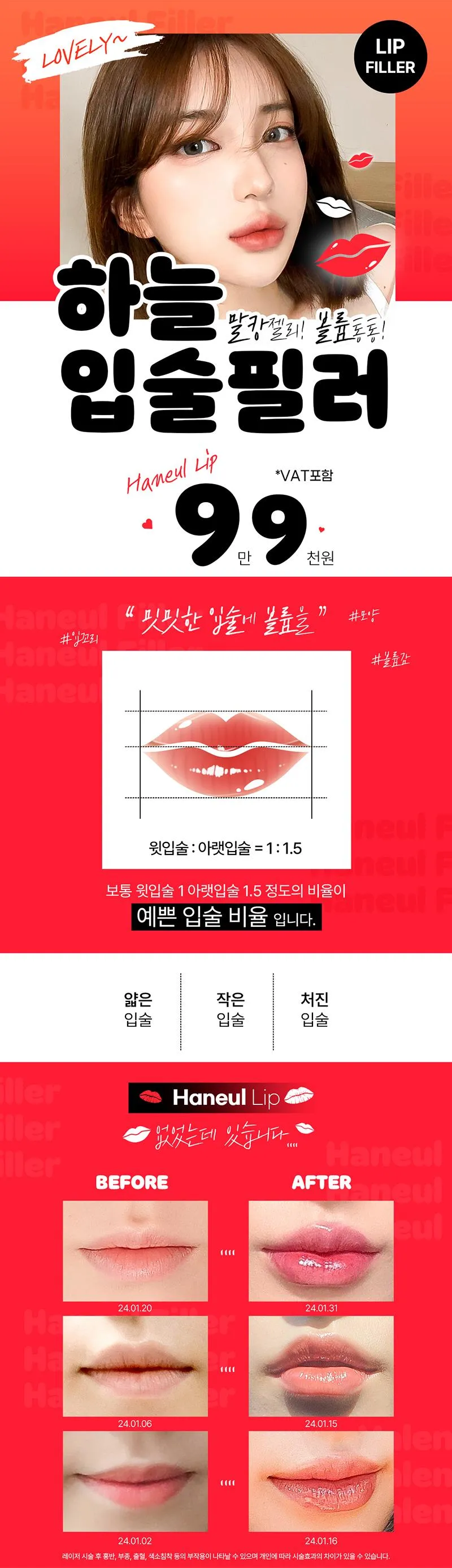 하늘성형외과의원 하늘 입술필러 이벤트, 시술 상세 이미지