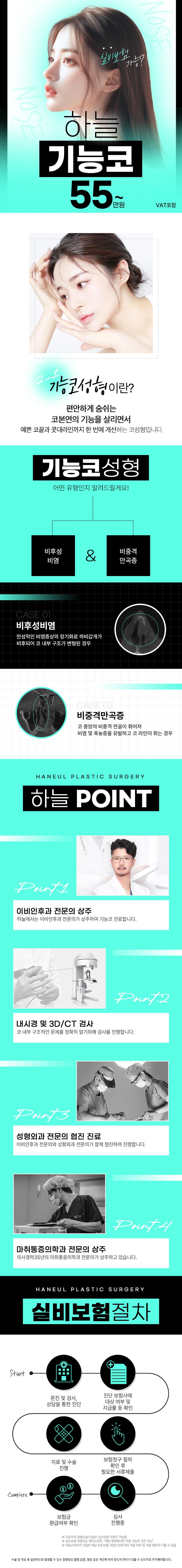 하늘성형외과의원 하늘 기능코성형 이벤트, 시술 상세 이미지