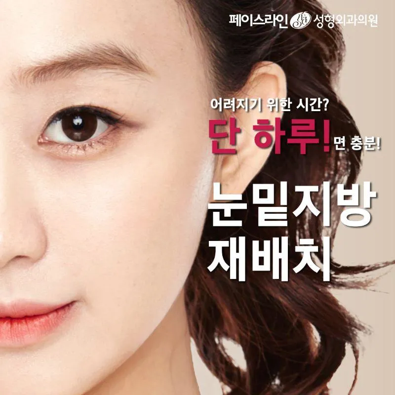 눈밑지방재배치